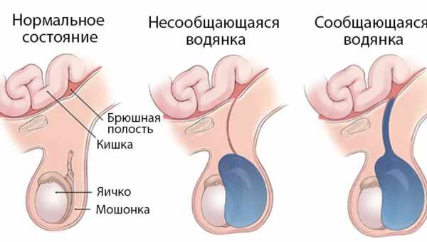 Почему у ребенка болят яички при прикосновении: причины дискомфорта, симптомы и лечение мальчика