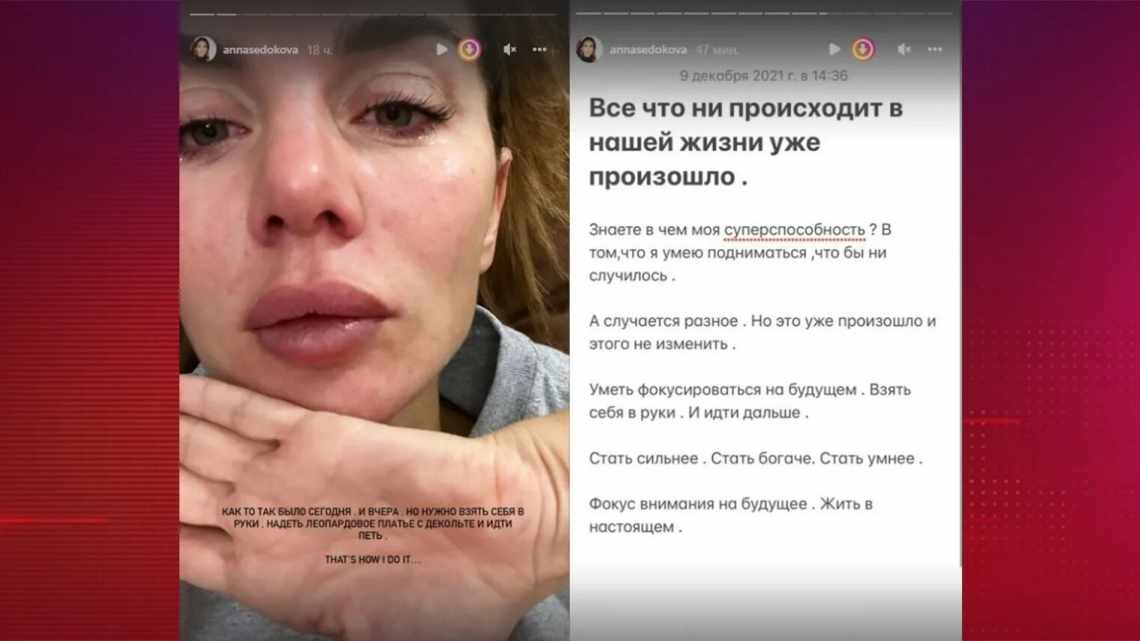 «Вы овцы»: Седокова призналась, что ее дочь переживает из-за насмешек хейтеров