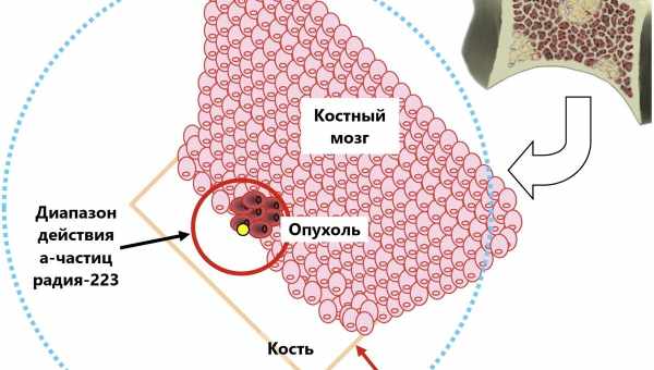 Раковые клетки метастазируют с чужой помощью