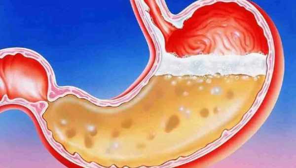 Гастродуоденит: когда еда не в радость