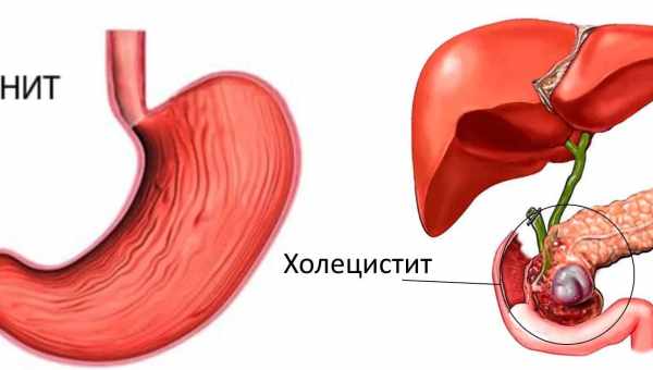 Гипомоторная дискинезия