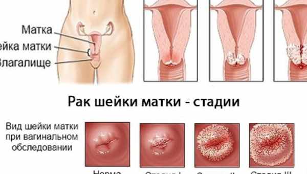 Почему опухают половые губы: причины и факторы. Какие меры предпринимать при проблемах интимного характера?